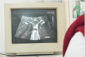 神秘地带B超仪1V978M：发现CC神秘地带内的惊喜！